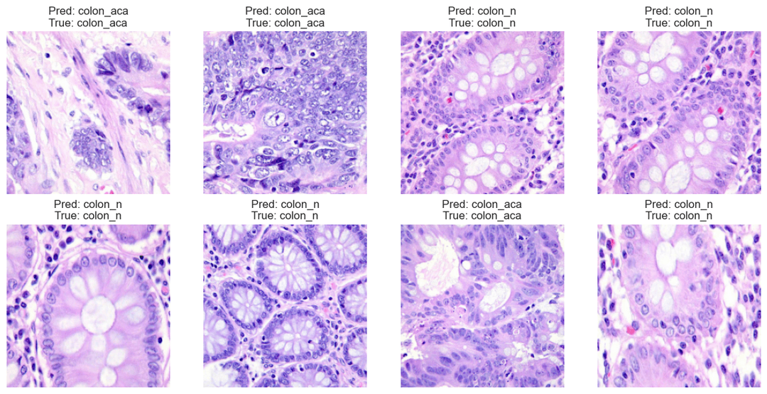 Colon Cancer Classification with Explainable AI